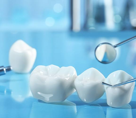 Dental bridge lying on a table