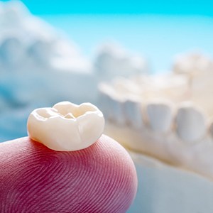 Dental crown on a tooth