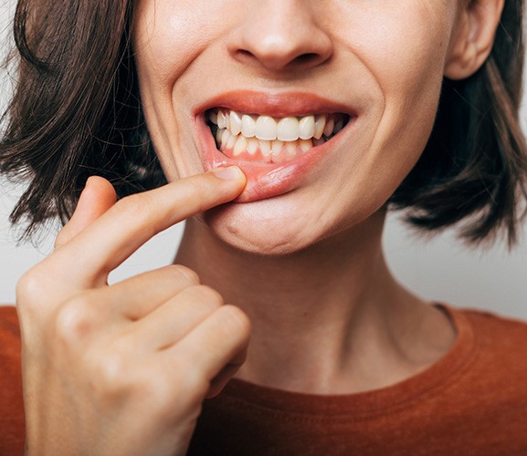 A woman revealing her infected gums