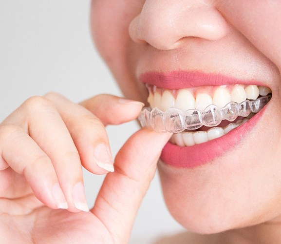 Woman about to wear aligner for Invisalign in Dallas, TX
