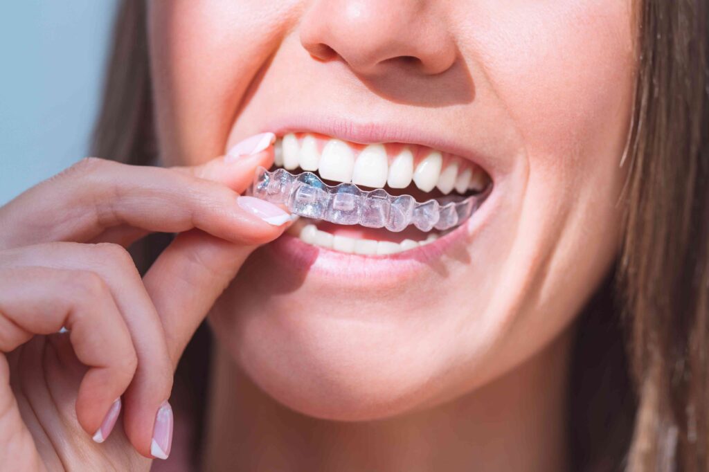Woman taking out aligners